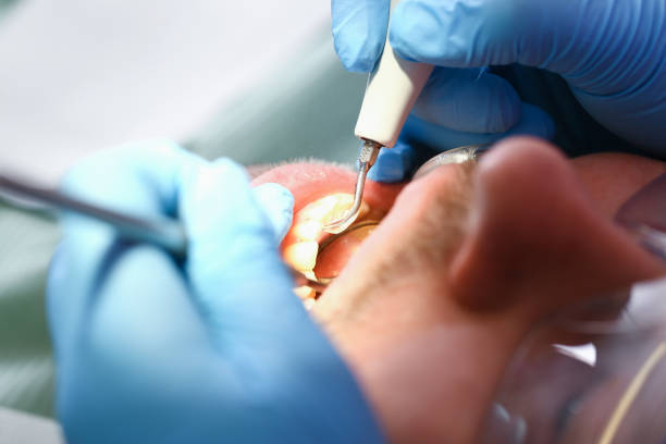 Best Urgent Dental Care for Toothache in Logan Elm Village, OH